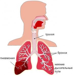 pnevmoniya-u-detej-i-vzroslyx Пневмония у детей и взрослых симптомы пневмонии